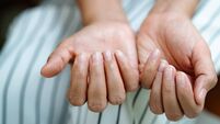 brittle damaged nails after using shellac or gel-lacquer
